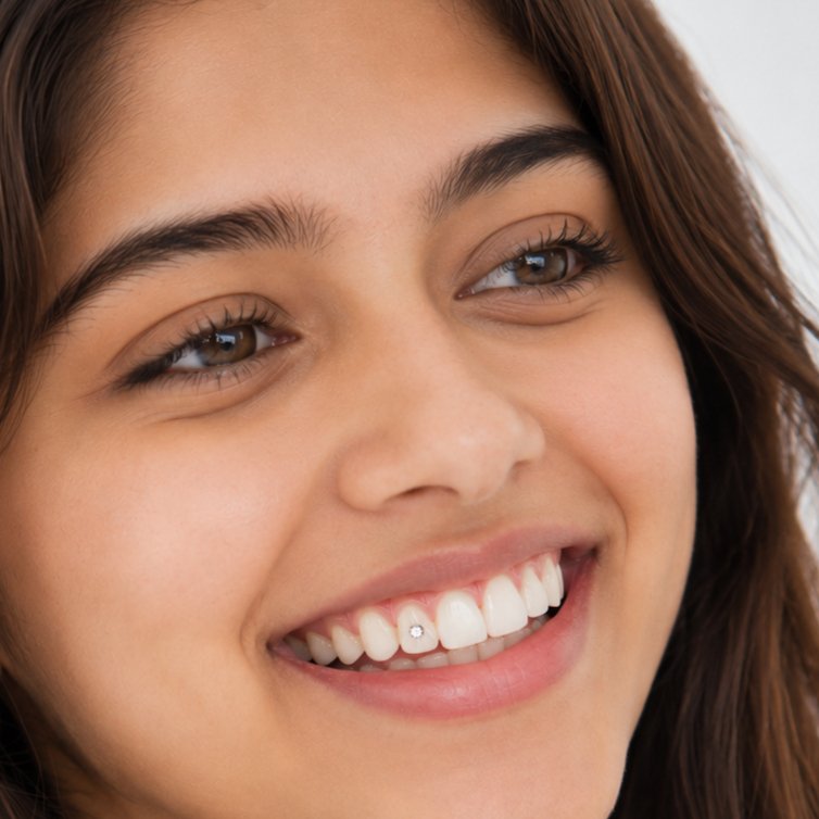 Tooth Jewellery